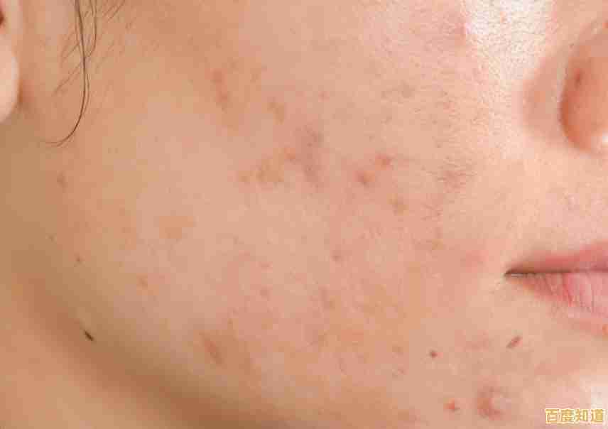 告别痘印烦恼,探索这些科学验证的有效护肤方法 告别痘印烦恼,探索这些科学验证的有效护肤方法